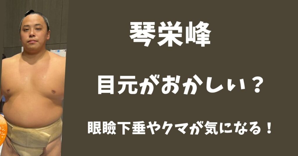 琴栄峰の目がおかしいと言われる理由は？眼瞼下垂で大きさが違う？